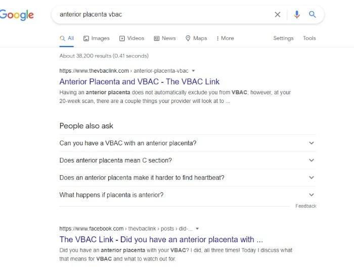 Google search results for anterior placenta VBAC